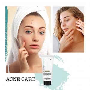 ACNE CARE